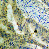 Anti-phospho-GluR1 (pSer849) antibody produced in rabbit affinity isolated antibody