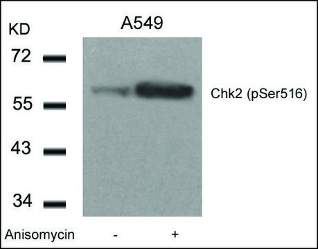 Anti-phospho-CHEK2 (pSer516) antibody produced in rabbit affinity isolated antibody