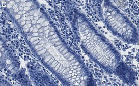 Anti-MLH1 Antibody, clone 1B15 ZooMAb&#174; Rabbit Monoclonal recombinant, expressed in HEK 293 cells