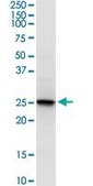 Monoclonal Anti-PRDX6 antibody produced in mouse clone 3A10-2A11, purified immunoglobulin, buffered aqueous solution