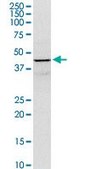 Anti-GOT1 antibody produced in rabbit purified immunoglobulin, buffered aqueous solution
