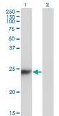 Monoclonal Anti-CBX5 antibody produced in mouse clone 1E11-3A10, purified immunoglobulin, buffered aqueous solution