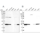 Anti-GSTP1 antibody produced in rabbit Prestige Antibodies&#174; Powered by Atlas Antibodies, affinity isolated antibody, buffered aqueous glycerol solution, Ab2