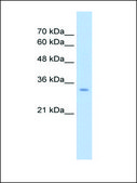 Anti-GLS2 IgG fraction of antiserum