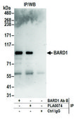 Rabbit anti-BARD1 Antibody, Affinity Purified Powered by Bethyl Laboratories, Inc.