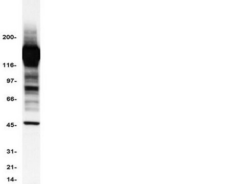 Anti-Phosphotyrosine Antibody, clone 4G10&#174;, HRP conjugate clone 4G10®, Upstate&#174;, from mouse