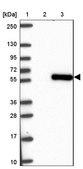 Anti-SMAD5 antibody produced in rabbit Prestige Antibodies&#174; Powered by Atlas Antibodies, affinity isolated antibody, buffered aqueous glycerol solution