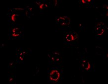 Anti-CXCR4-Lo antibody produced in rabbit purified immunoglobulin (IgG)