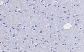 Anti-CRBN Antibody, clone 3I23 ZooMAb® Rabbit Monoclonal recombinant, expressed in HEK 293 cells
