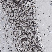 Anti-HNRNPH2 antibody produced in rabbit Prestige Antibodies&#174; Powered by Atlas Antibodies, affinity isolated antibody, buffered aqueous glycerol solution