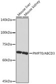 Anti-PMP70/ABCD3 Antibody, clone 3V4K3, Rabbit Monoclonal