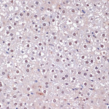 Anti-CDKN2A/p16INK4a antibody produced in rabbit