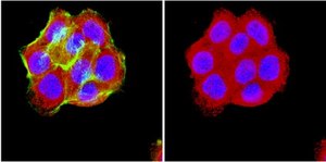 Anti-Opioid Receptor Antibody, &#181;, pain serum, Chemicon&#174;