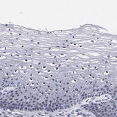 Anti-RAF1 antibody produced in rabbit Prestige Antibodies&#174; Powered by Atlas Antibodies, affinity isolated antibody, buffered aqueous glycerol solution