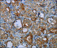 Anti-CYP7A1 antibody produced in rabbit affinity isolated antibody