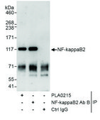 Rabbit anti-NF-kappaB2 Antibody, Affinity Purified Powered by Bethyl Laboratories, Inc.