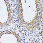 Anti-ERK1/ERK2 antibody produced in rabbit