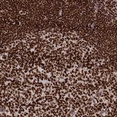 Monoclonal Anti-PARP1 antibody produced in mouse Prestige Antibodies&#174; Powered by Atlas Antibodies, clone CL2220, purified immunoglobulin, buffered aqueous glycerol solution