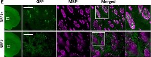 Anti-Myelin Basic Protein Antibody, a.a. 82-87 culture supernatant, clone 12, Chemicon&#174;