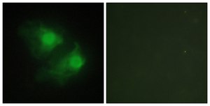 Anti-LIMK2 antibody produced in rabbit affinity isolated antibody