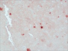 Anti-&#946;-Amyloid antibody, Mouse monoclonal clone BAM-10, ascites fluid