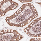 Anti-TOMM70 antibody produced in rabbit Prestige Antibodies&#174; Powered by Atlas Antibodies, affinity isolated antibody, buffered aqueous glycerol solution