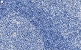 Anti-Lck Antibody, clone 2B20 ZooMAb® Rabbit Monoclonal recombinant, expressed in HEK 293 cells