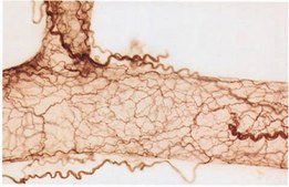Anti-Nerve Growth Factor Receptor Antibody, extracellular, clone 192-IgG clone 192-IgG, Chemicon&#174;, from mouse