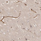 Anti-TJP1 antibody produced in rabbit Ab2, Prestige Antibodies&#174; Powered by Atlas Antibodies, affinity isolated antibody, buffered aqueous glycerol solution