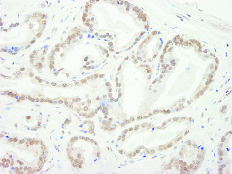 Rabbit anti-CBX5 Antibody, Affinity Purified Powered by Bethyl Laboratories, Inc.