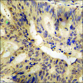 Anti-phospho-p53 (pSer366) antibody produced in rabbit affinity isolated antibody