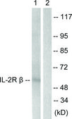 Anti-IL-2R &#946; antibody produced in rabbit affinity isolated antibody