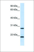 Anti-MUC1 antibody produced in rabbit affinity isolated antibody