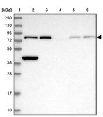 Anti-ERCC2 antibody produced in rabbit Prestige Antibodies&#174; Powered by Atlas Antibodies, affinity isolated antibody, buffered aqueous glycerol solution