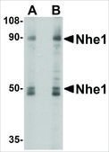Anti-Nhe-1 (ab2) antibody produced in rabbit affinity isolated antibody, buffered aqueous solution