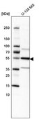 Anti-IL1R1 antibody produced in rabbit Prestige Antibodies&#174; Powered by Atlas Antibodies, affinity isolated antibody, buffered aqueous glycerol solution