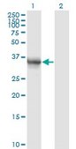 Monoclonal Anti-AKR1B10 antibody produced in mouse clone 1A6, purified immunoglobulin, buffered aqueous solution
