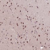Anti-CHMP4B antibody produced in rabbit Prestige Antibodies&#174; Powered by Atlas Antibodies, affinity isolated antibody, buffered aqueous glycerol solution