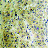 Anti-phospho-SYK (pTyr525) antibody produced in rabbit affinity isolated antibody
