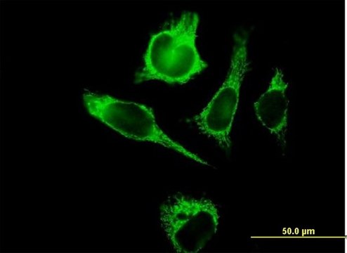 Anti-TUFM antibody produced in mouse purified immunoglobulin, buffered aqueous solution