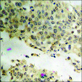 Anti-phospho-ATF2 (pThr73 or 55) antibody produced in rabbit affinity isolated antibody