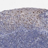 Anti-ZNF750 antibody produced in rabbit Prestige Antibodies&#174; Powered by Atlas Antibodies, affinity isolated antibody, buffered aqueous glycerol solution, Ab2