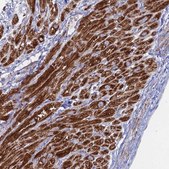 Anti-MPC1 antibody produced in rabbit Prestige Antibodies&#174; Powered by Atlas Antibodies, affinity isolated antibody, buffered aqueous glycerol solution