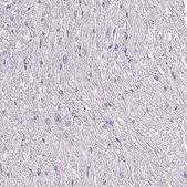 Anti-C2CD3 antibody produced in rabbit Prestige Antibodies&#174; Powered by Atlas Antibodies, affinity isolated antibody, buffered aqueous glycerol solution