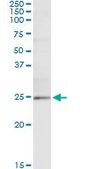 Monoclonal Anti-TWIST1 antibody produced in mouse clone 2G12, purified immunoglobulin, buffered aqueous solution