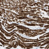 Anti-DES antibody produced in rabbit Prestige Antibodies&#174; Powered by Atlas Antibodies, affinity isolated antibody, buffered aqueous glycerol solution