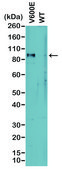 Anti-BRAF (V600E) antibody, Rabbit monoclonal recombinant, expressed in HEK 293 cells, clone RM8, purified immunoglobulin