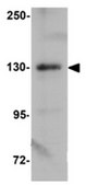 Anti-ZEB1 Antibody from rabbit, purified by affinity chromatography