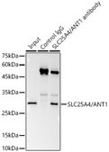 [KO Validated]Anti-SLC25A4/ANT1 Antibody, clone 3C1Q3, Rabbit Monoclonal