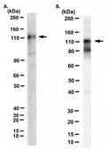 Anti-Pyk2/CAK&#946; Antibody